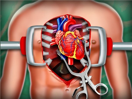 模拟心脏手术图0