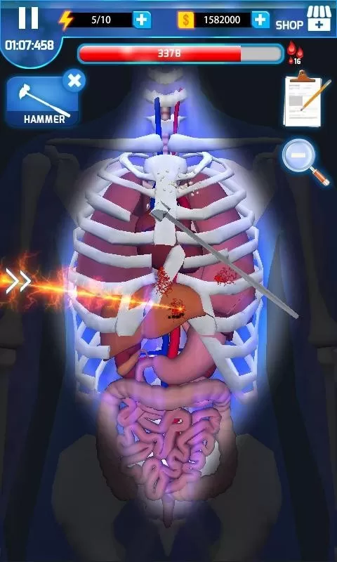 手术大师中文版(Surgery Master)游戏下载官方正式版图1