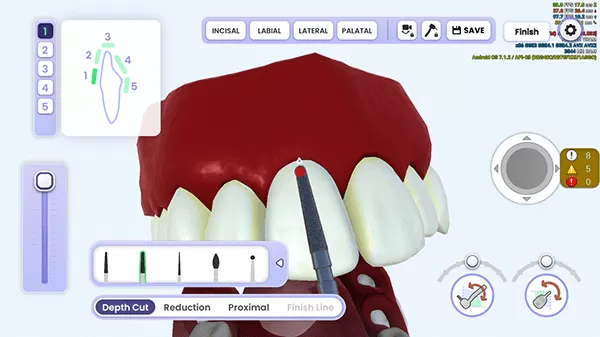 牙医模拟器(Dentist Simulation)安卓最新版免费下载图0