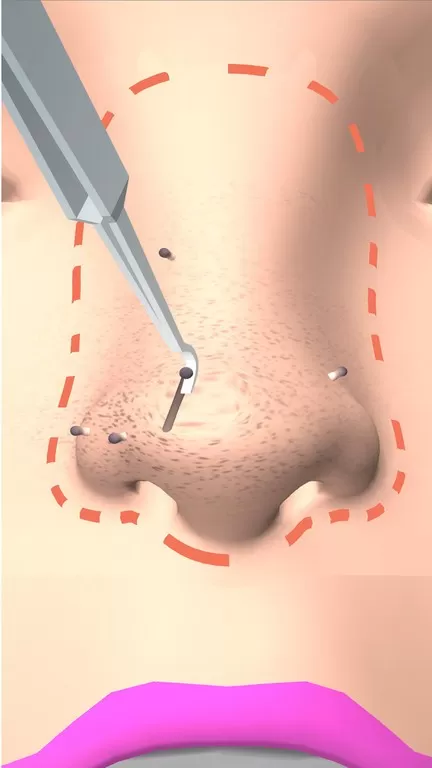 挤黑头大师游戏最新版图1