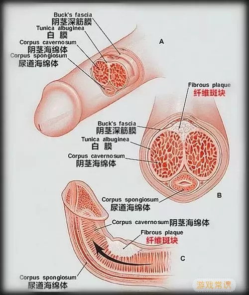 海绵体胀痛怎么办