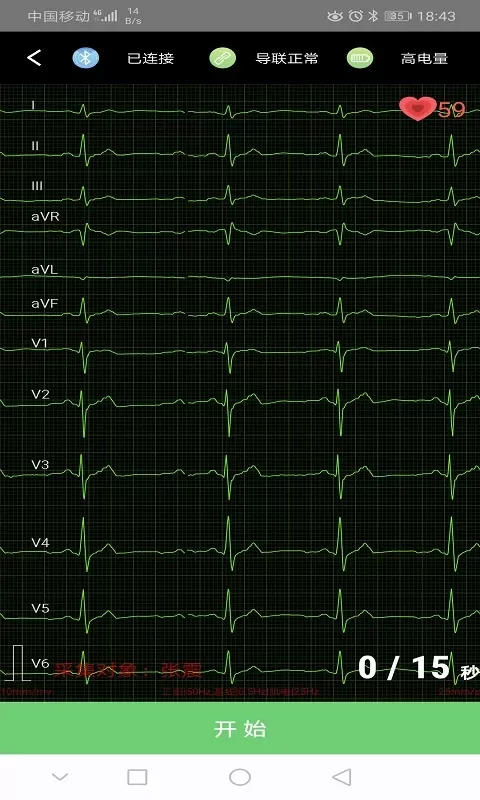 康乃心测心电安卓版最新版图3