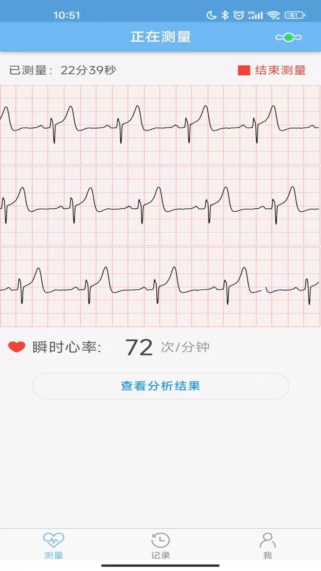 数维康心电最新版本图2