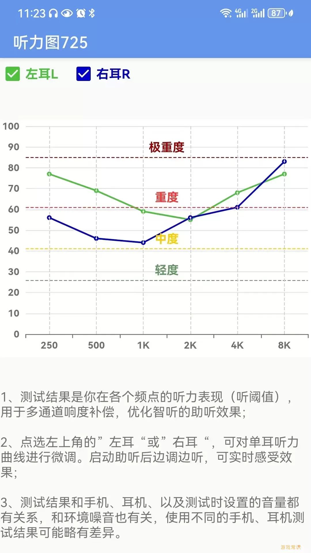 智听最新版本下载